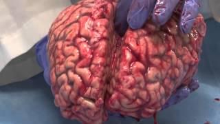 The Unfixed Brain