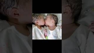 twins baby crying together #shorts