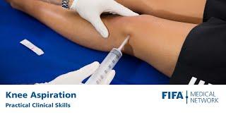 Knee Aspiration | Practical clinical skills