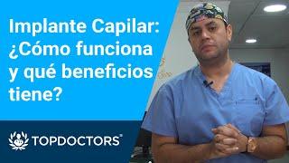 Implante Capilar: ¿Cómo funciona y qué beneficios tiene?