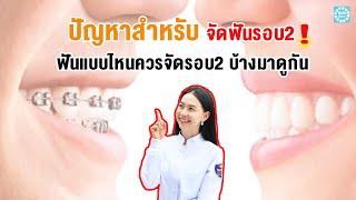 ปัญหาสำหรับคนจัดฟันรอบ2 มีอะไรบ้าง..ฟันแบบไหนควรจัดรอบ2 บ้างมาดูกัน!!