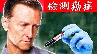 預防癌症,驗血了解細胞損傷，最佳血液檢測,柏格醫生 Dr Berg