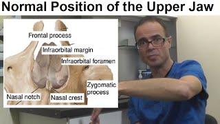 What is the Normal Position/ Posture of the Upper Jaw/ Maxilla or Palate by Dr Mike Mew