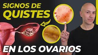 SI TIENES UNO DE ESTOS SÍNTOMAS PUEDES TENER QUISTES EN LOS OVARIOS | ¿CURAR EL OVARIO POLIQUÍSTICO?