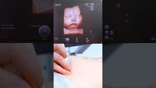 A cute baby 4D face is shown developing in the mother's womb#shorts