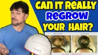 RED LIGHT Therapy Device For Thinning Hair? |  iRestore Product Review  | Chris Gibson
