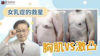 【台中女乳症｜案例分享】 胸肌VS激凸 男性女乳症客製複合式手術｜整形外科林雍球醫師