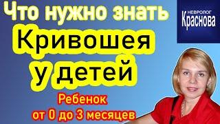 Кривошея у детей. Что нужно знать. Ребенок от 0 до 3 месяцев. Невролог Краснова