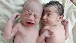 Twins after birth where one is fed up with other one cry || Just Stop It 