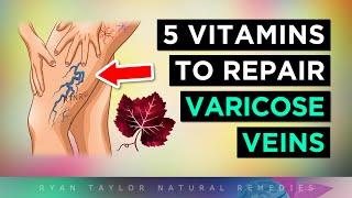 5 Vitamins For Venous Insufficiency (VARICOSE Veins Remedies)