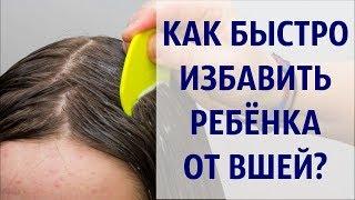 Как быстро избавить ребёнка от вшей / Педикулёз у ребенка