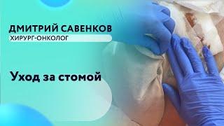 Уход за стомой I Хирург-онколог I Дмитрий Савенков I Днепр