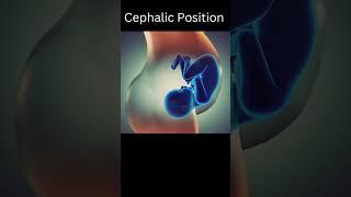 Cephalic Orientation of Baby