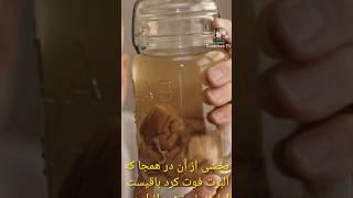چه بلایی به سر مغز آلبرت انیشتین اومد ️#انیشتین #عجیب #عجایب_دنیا