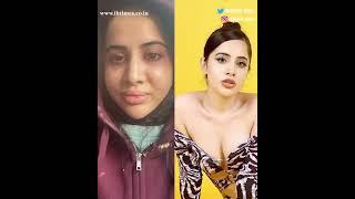 Urfi Javed shares picture with a swollen face: "Kya se kya ho gaya"