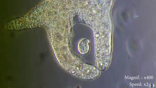 Amoeba eats  paramecia ( Amoeba's lunch ) [ Amoeba Endocytosis / Phagocytosis  Part 1 ] 