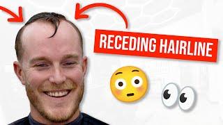 How to cut a Receding Hairline 