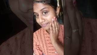 HOW TO REMOVE DARK CIRCLES |ACNE, PIGMENTATION BLEMISHES REMOVAL #yt #potato #glow #darkcircles #yts