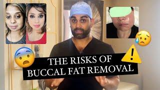 What are the RISKS of buccal fat removal!? *MUST WATCH BEFORE SURGERY*