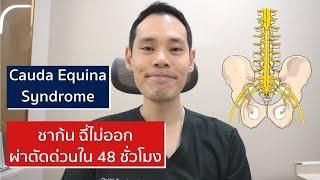 Unable to hold pee Need urgent spinal surgery within 48 hrs. Cauda Equina Syndrome | EasyDoc EP.43