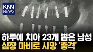 치아 23개 발치 후 임플란트 12개 이식했다가 결국... / KNN