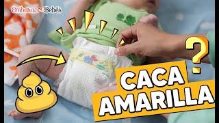 🟡 ¿Qué causa la CACA AMARILLA en Bebés? ¿Son normales?