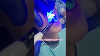 Shade matching of single front tooth is most challenging task | Dontia Dental Care #youtubeshorts