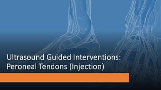 #ultrasound Guided Interventions: #Peroneal #tendon (#injection) #fyp #sportsmedicine #sportsdoctor