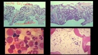 Blood Cells and Bone Marrow (Part 2 of 2)