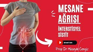 AĞRILI MESANE  SENDROMU - İNTERSTİSYEL SİSTİT   (mesane ağrısı) (Prof Dr Hüseyin CENGİZ)