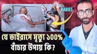 Rabies ভাইরাস শরীরে ঢুকলে কি ঘটে? নিশ্চিত মৃত্যু থেকে বাঁচার উপায় কি? Sabbir Ahmed