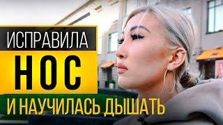Как исправить искривленную перегородку носа? Ринопластика после травмы