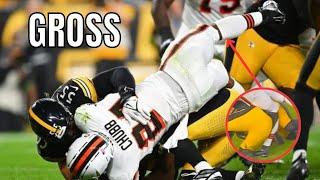 NFL "GROSSEST" INJURIES 