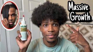 How To Apply Wild Growth Hair Oil To Afro Hair For Massive Hair Growth