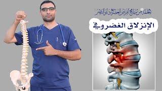 الانزلاق الغضروفي-الحلقة 1 من برنامج أمراض العصر