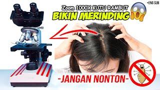 INILAH KUTU RAMBUT DAN TELURNYA DI MIKROSKOP | Head Lice Under Microscope Zoom 1000X