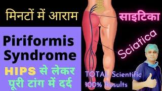 Sciatica dard kaise theek kare | साइटिका दर्द का इलाज | Piriformis Syndrome kya hota hai