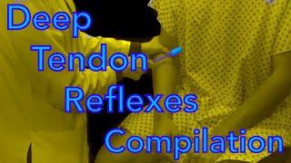 The Deep Tendon Reflexes Compilation (Sources for all clips are in the description)