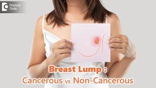 Breast Lumps:Cancerous vs Non-Cancerous |Are all lumps dangerous?-Dr.Nanda Rajneesh| Doctors' Circle