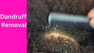 Dandruff Removal - Large flakes - thorough scratch