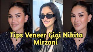 Tips Veneer Gigi Nikita Mirzani