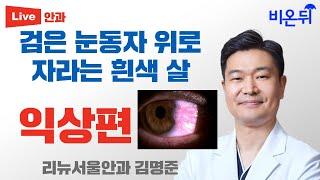 검은 눈동자 위로 자라는 흰색 살: 익상편 (리뉴서울안과 김명준)