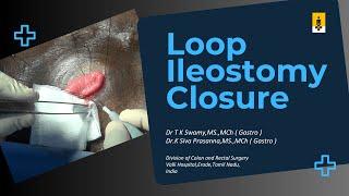 Loop Ileostomy Closure – Learn It Right, Close It Tight | Dr. T. K. Swamy