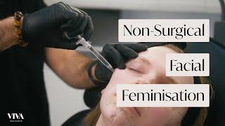 Full Face of Filler Feminisation | Trans woman | Natural Dermal Filler Before and After (2022)