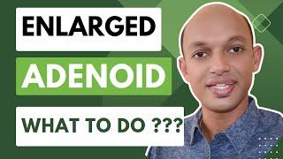 Adenoid problems in children | Clear your doubts with DrSandeepKRaj #Pediatrician