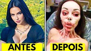 20 pessoas que levaram suas cirurgias plásticas longe demais