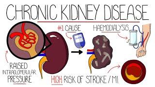 Understanding Chronic Kidney Disease (CKD)