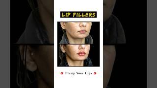 The Secret to Fuller Lips! | Sarayu Clinics #lipfiller