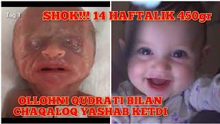 OLLOHNI QUDRATI BILAN 14 HAFTALIK 450gr TUG‘ILGAN QIZALOQ YASHAB KETDI...MASHALLAX!!! 14 week born..