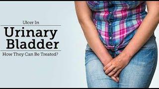 Interstitial Cystitis (Bladder Ulcer)